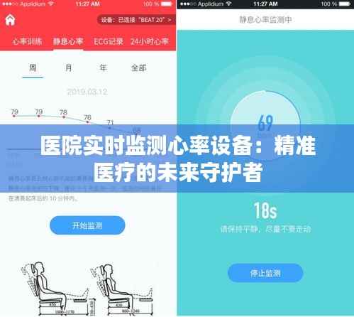 医院实时监测心率设备:精准医疗的未来守护者