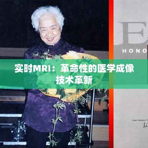 实时MRI:革命性的医学成像技术革新