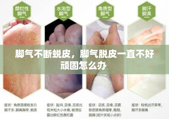 脚气不断蜕皮,脚气脱皮一直不好顽固怎么办