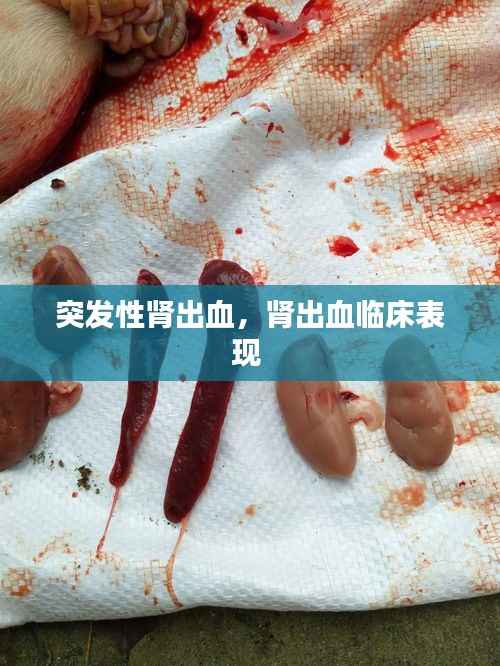 突发性肾出血,肾出血临床表现