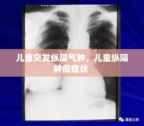 儿童突发纵隔气肿,儿童纵隔肿瘤症状