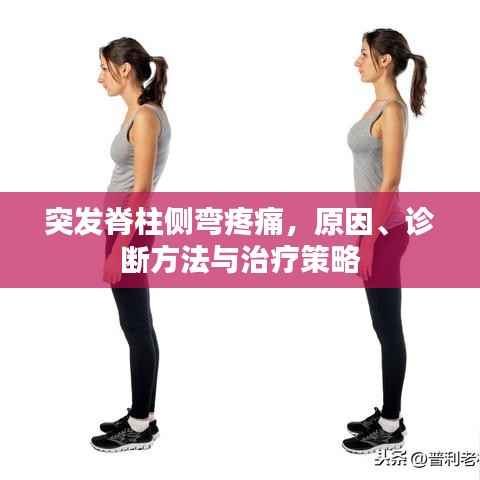 突发脊柱侧弯疼痛,原因、诊断方法与治疗策略