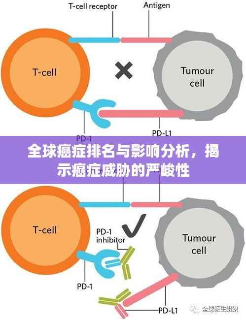 全球癌症排名与影响分析，揭示癌症威胁的严峻性
