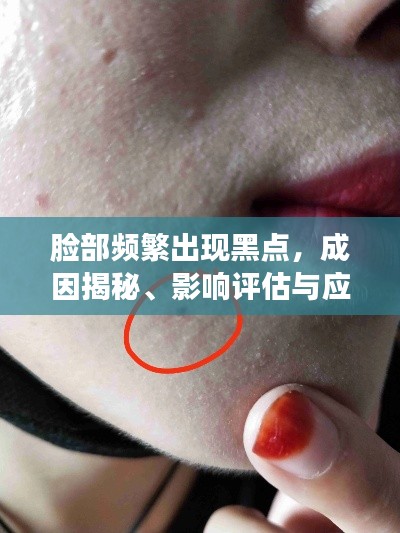 脸部频繁出现黑点,成因揭秘、影响评估与应对方案